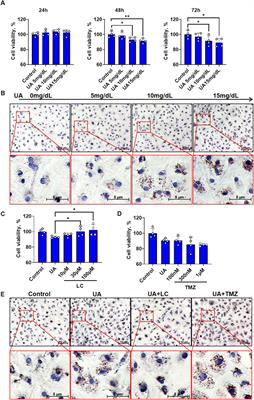 L-carnitine attenuated hyperuricemia-associated left ventricular remodeling through ameliorating cardiomyocytic lipid deposition